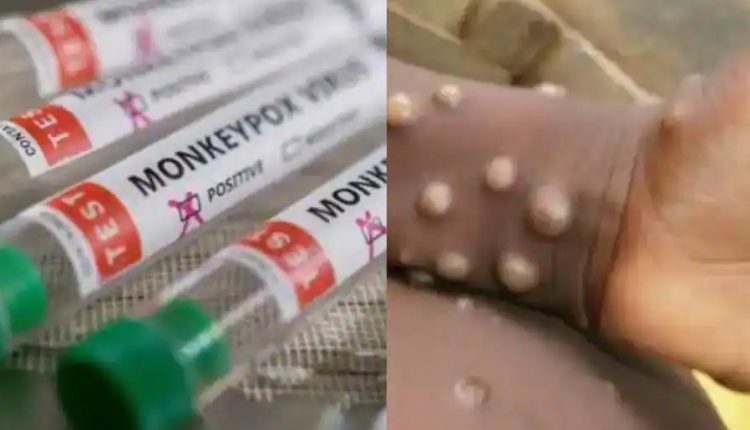 Odisha Govt To Increase Surveillance Of Travellers From Affected Countries Due To Monkeypox