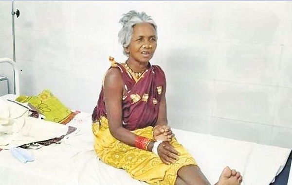 Padma Shri Kamala Pujari’s Health Condition Worsens, Shifted To Cuttack SCB