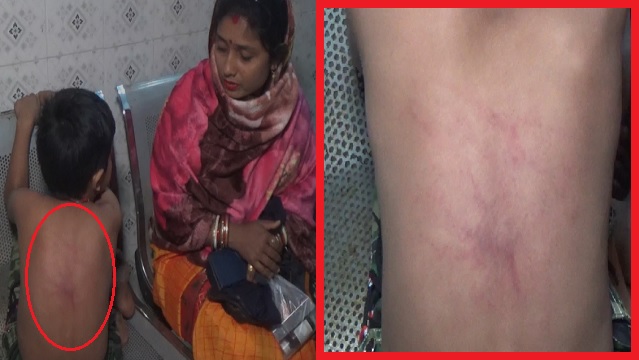 Teacher beats Beats’ 6-Yr-Old in Odisha, family lodges FIR