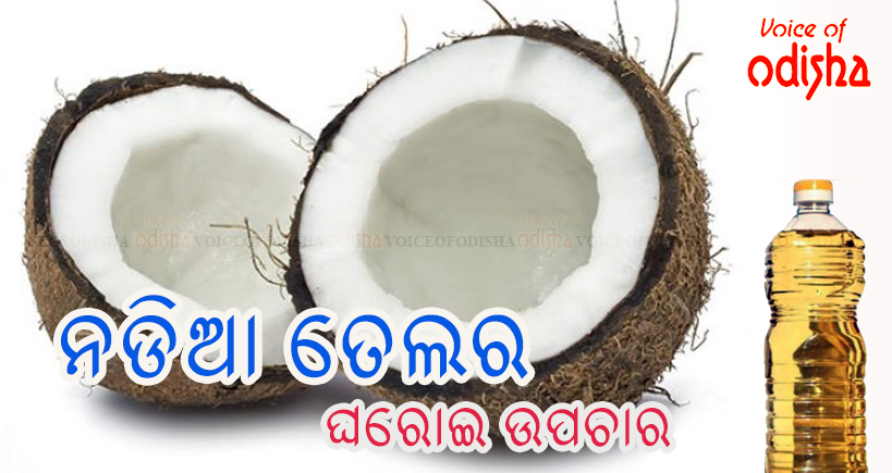 ନଡିଆ ତେଲର ଘରୋଇ ଉପଚାର