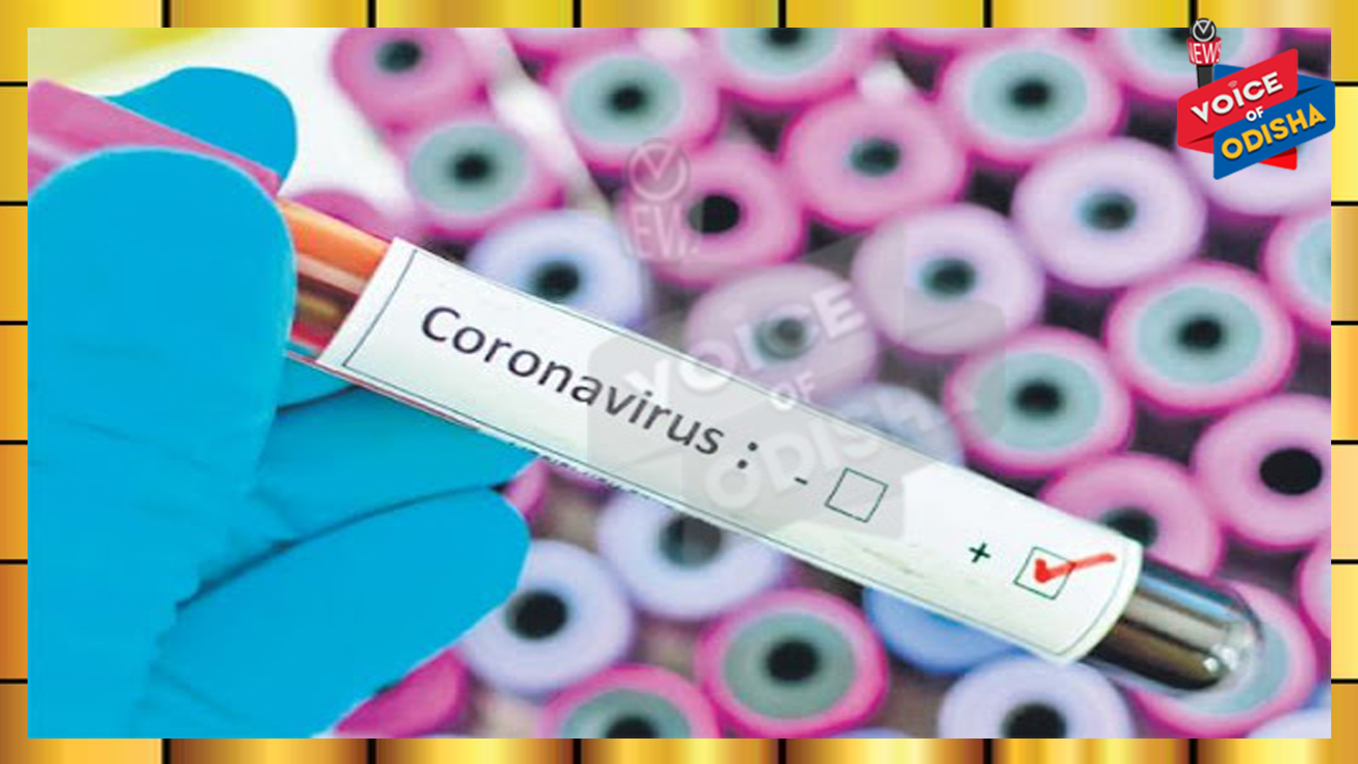 କରୋନା ଦ୍ୱିତୀୟ ଢେଉ : ରାଜ୍ୟରେ ଆଜି ୬୧୬୪ ନୂଆ କରୋନା ପଜିଟିଭ ଚିହ୍ନଟ