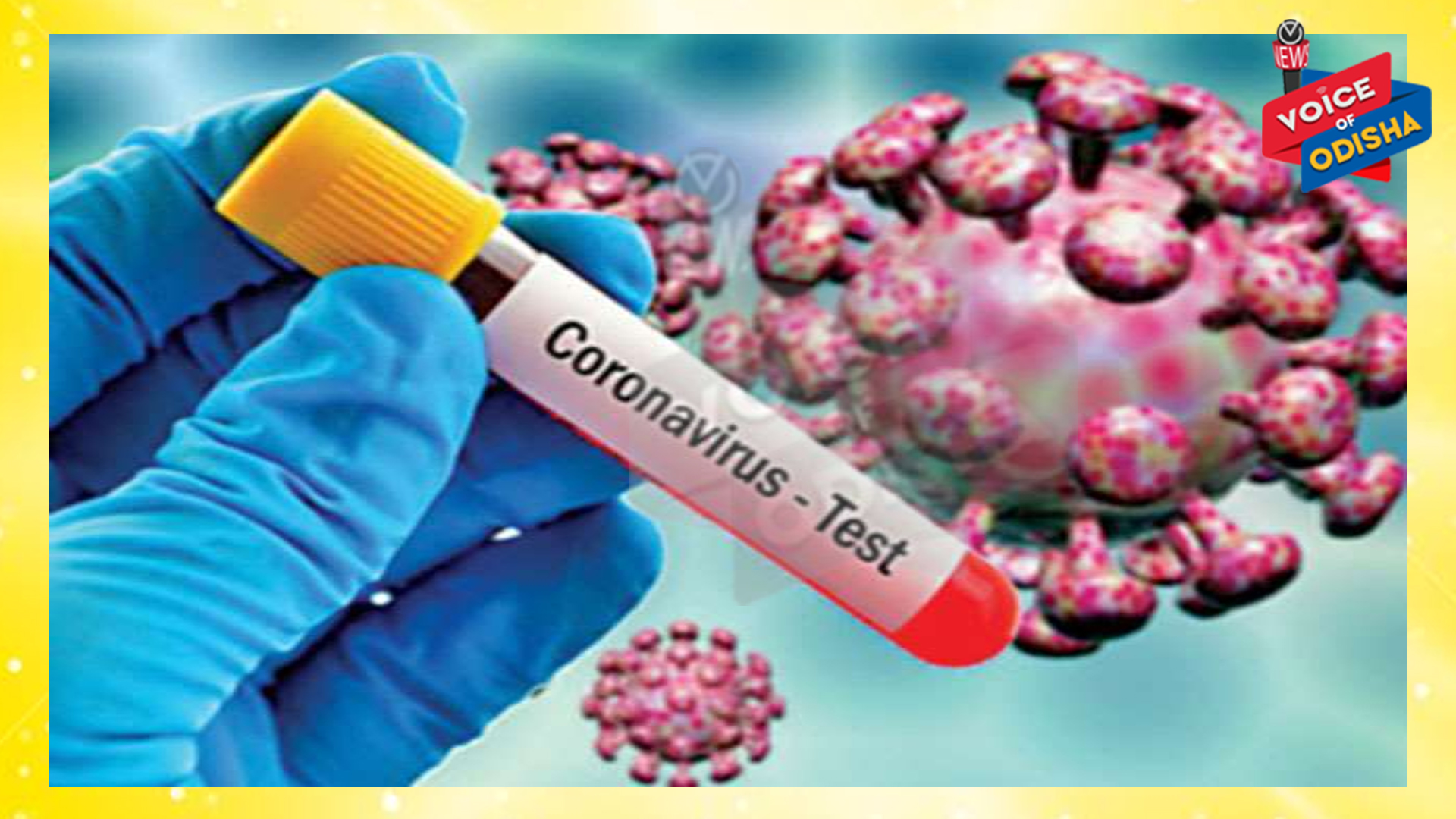 କରୋନା ଦ୍ୱିତୀୟ ଢେଉ :  ରାଜ୍ୟରେ ଆଜି ୬୨୧୫ ନୂଆ କରୋନା ପଜିଟିଭ ଚିହ୍ନଟ