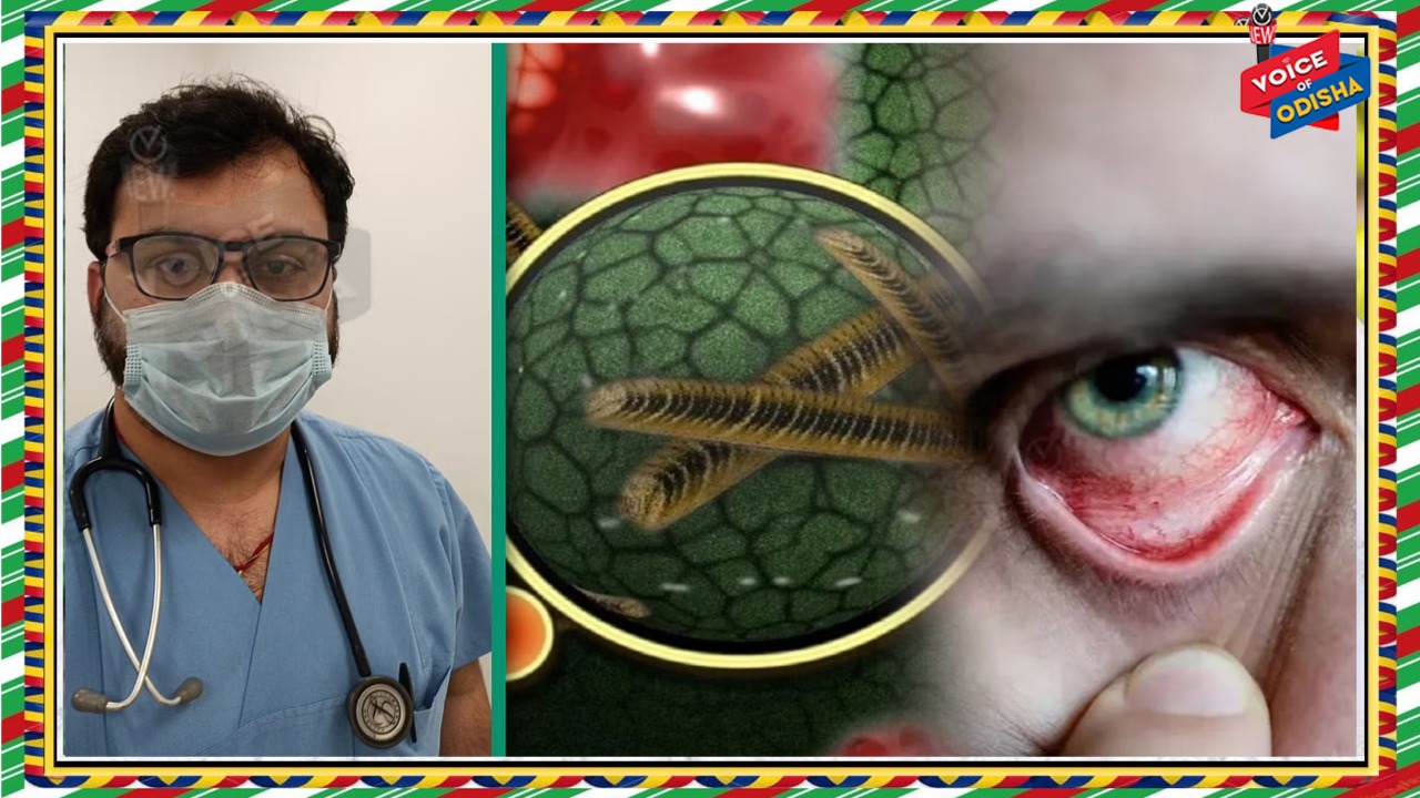 କୋଭିଡରୁ ଆରୋଗ୍ୟଲାଭ କରୁଥିବା ପୀଡ଼ିତଙ୍କ ଠାରେ ‘ବ୍ଳାକ ଫଙ୍ଗସ୍’ ସଂକ୍ରମଣ ଏବେ ଚିନ୍ତାର ବିଷୟ 