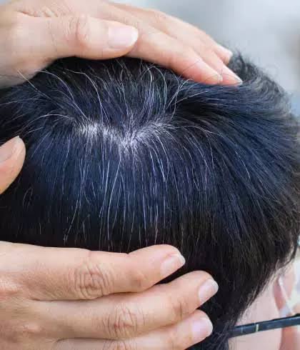 କେଶ ଧଳା ହୋଇଯାଉଛି କି 