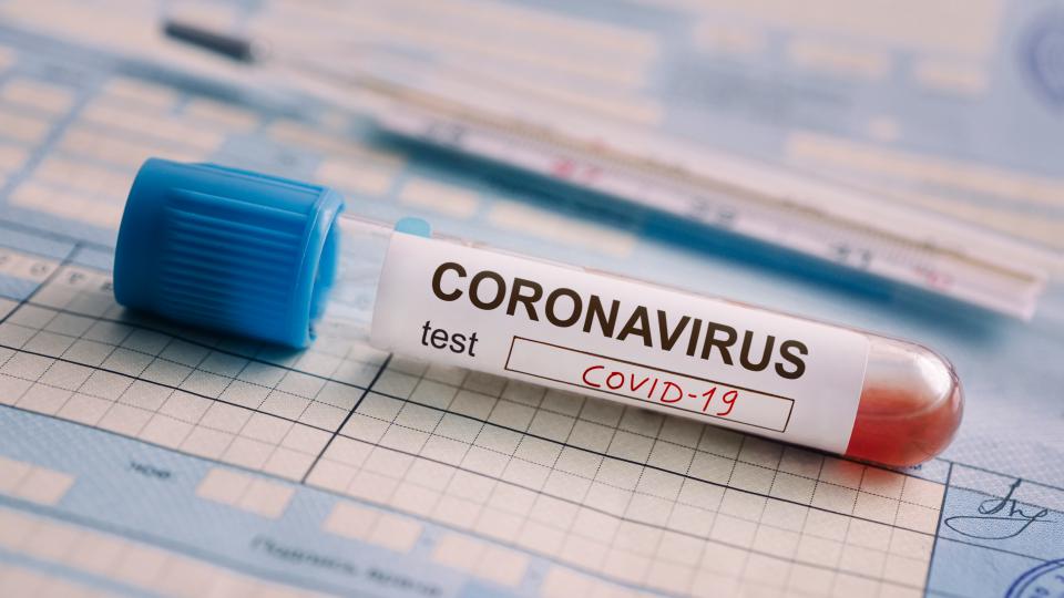 ୨୪ ଘଣ୍ଟାରେ  ୨୦ କରୋନା ପଜିଟିଭ୍ 