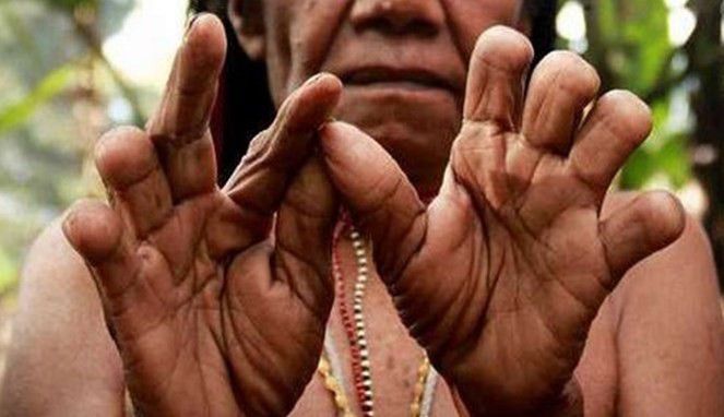 ପରିବାର ସଦସ୍ୟଙ୍କ ମୃତ୍ୟୁରେ କଟାଯାଏ ମହିଳାଙ୍କ ଆଙ୍ଗୁଳି