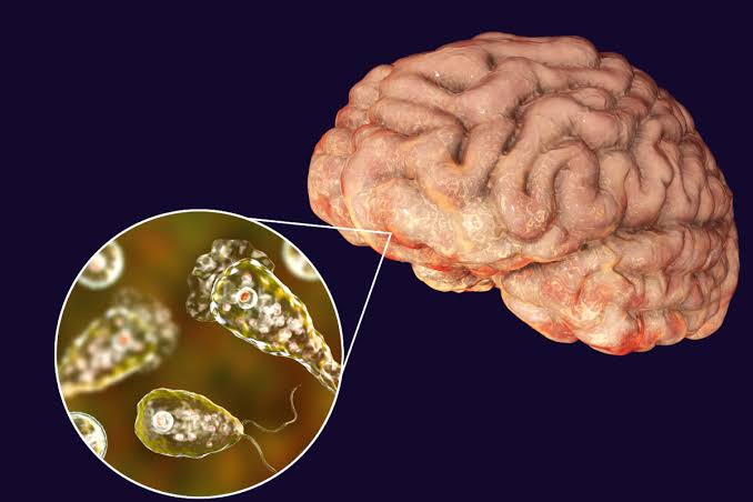 ମସ୍ତିଷ୍କକୁ ନଷ୍ଟ କରେ ଏହି ବିଷାକ୍ତ ଜୀବ