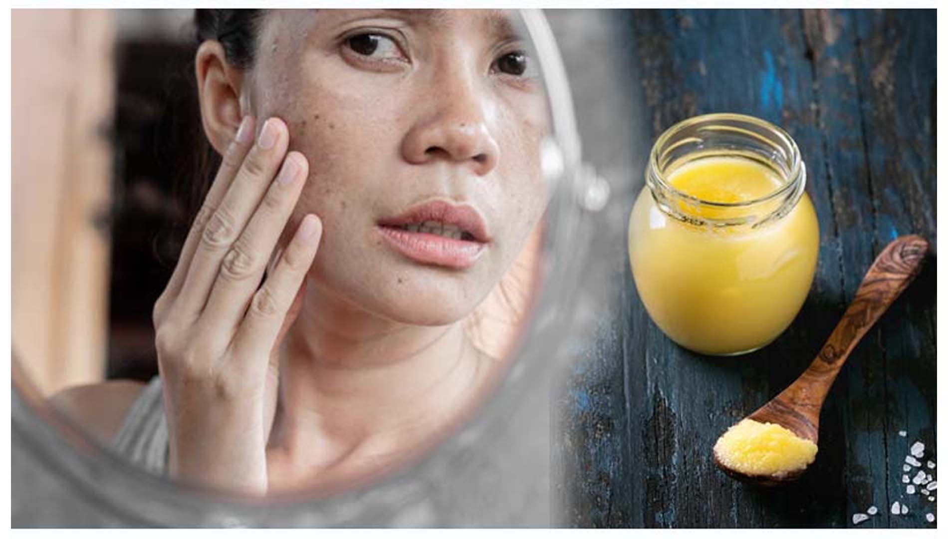  ଶୀତଦିନେ ତ୍ୱଚାରେ ଲଗାନ୍ତୁ ଦେଶୀ ଘିଅ, ଚମକିବ ତ୍ୱଚା 