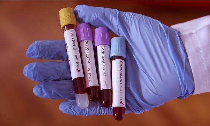 ରାଜଭବନରେ ପହଞ୍ଚିଲା କରୋନା ।