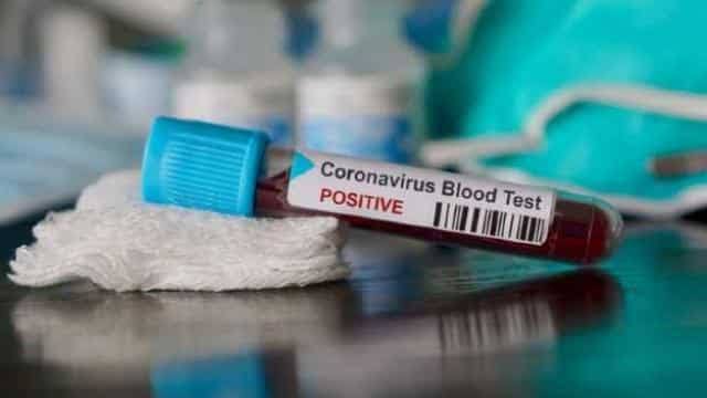 ରାଜ୍ୟରେ ପୁଣି 14 କରୋନା ଆକ୍ରାନ୍ତ ଚିହ୍ନଟ,  ଆକ୍ରାନ୍ତଙ୍କ ସଂଖ୍ୟା 391କୁ ବୃଦ୍ଧି |