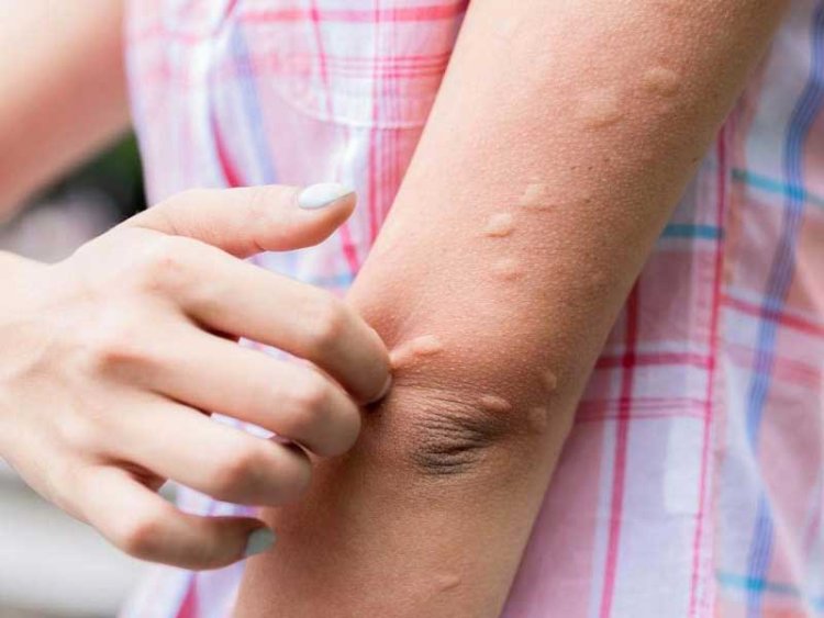 ସୋରରେ ଜାପାନିଜ ଏନଶେଫାଲାଇଟିସ୍ ଆତଙ୍କ