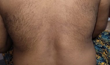 Youth tortured in police custody in Jagatsinghpur