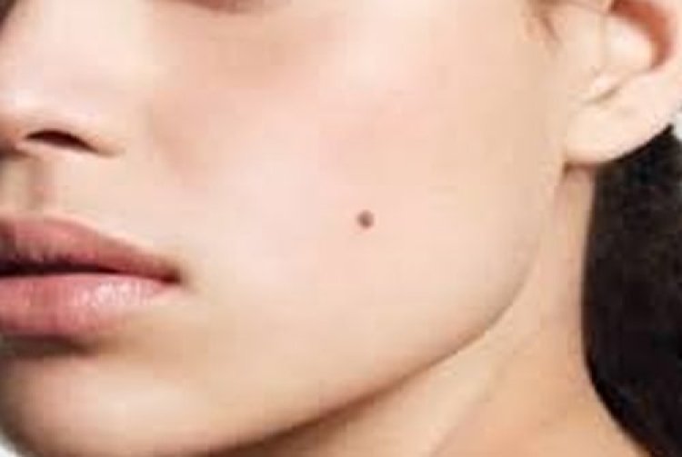 କଳାଜାଇ କହିବ ଭାଗ୍ୟ...