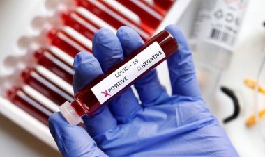 କୋଭିଡ୍‌-୧୯ :ଦେଶରେ ୧୬୯ ନୂତନ ଆକ୍ରାନ୍ତ ଚିହ୍ନଟ