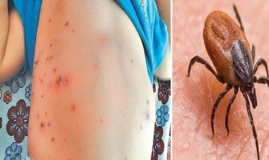 Odisha Govt On Alert Mode After Scrub Typhus Kills 5 People