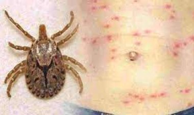 ସ୍କ୍ରବ ଟାଇଫସ : ସୁନ୍ଦରଗଡ଼ରେ ଆଉ ୬ ରୋଗୀ ଚିହ୍ନଟ