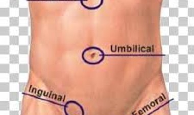 ହାର୍ନିୟାର ଲକ୍ଷଣକୁ ଅଣଦେଖା କରିବା ଉଚିତ୍ ନୁହେଁ