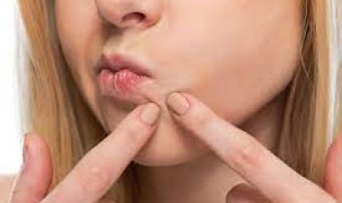 ସୃଷ୍ଟିକାରୀ ବୀଜାଣୁ  କମାଇବ   ବ୍ରଣ !