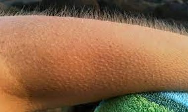 ଡର କିମ୍ବା ଥଣ୍ଡା ଲାଗିଲେ କାହିଁକି ଟାଙ୍କୁରି ଉଠେ ଲୋମ? ଜାଣନ୍ତୁ କାରଣ