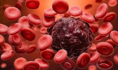 ଜାଣନ୍ତୁ, କର୍କଟ ରୋଗର କାରଣ ଓ ଲକ୍ଷଣ