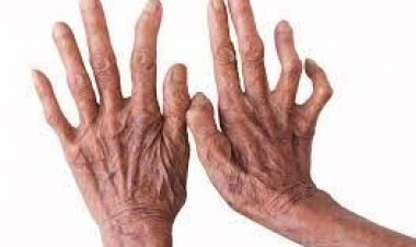 ଜାଣନ୍ତୁ କୁଷ୍ଠ ଡିଆଁ ରୋଗ କି ନୁହେଁ? ଏହା କେତେ ମାରାତ୍ମକ !