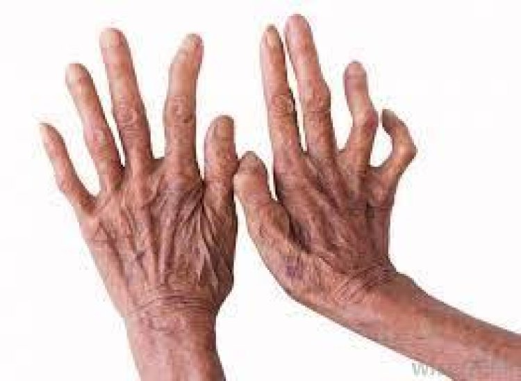 ଜାଣନ୍ତୁ କୁଷ୍ଠ ଡିଆଁ ରୋଗ କି ନୁହେଁ? ଏହା କେତେ ମାରାତ୍ମକ !