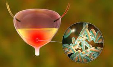 ଏହି ସବୁ ଲକ୍ଷଣକୁ ହୋଇପାରେ ୟୁରିନାରୀ ଟ୍ରାକ୍ଟ ଇନଫେକ୍ସନ