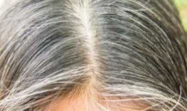 ବୟସ ହେବା ପୂର୍ବରୁ ହୋଇଯାଉଛି କି ଧଳା କେଶ ? ଆପଣାନ୍ତୁ ଏହି ୪ଟି ଘରୋଇ ଉପଚାର