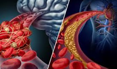 କିଭଳି ପାଇବେ ହାର୍ଟ ଷ୍ଟ୍ରୋକରୁ ମୁକ୍ତି?