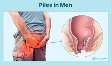 ପାଇଲ୍ସରେ ପୀଡ଼ିତ କି? ଅଶୋକ ଗଛର ଛେଲି ଓ ଫୁଲ ବ୍ୟବହାର କରନ୍ତୁ