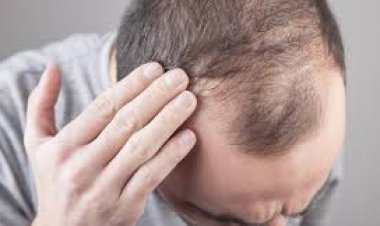 ଚନ୍ଦାପଣରୁ ମୁକ୍ତି ଦେଇଥାଏ ଏହି ଖାଦ୍ୟ