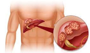 ଜାଣନ୍ତୁ ଯକ୍ଷ୍ମା ରୋଗର କାରଣ ଓ   ଲକ୍ଷଣ