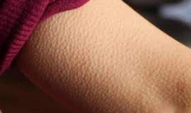 ଡର କିମ୍ବା ଥଣ୍ଡା ଲାଗିଲେ,  ଲୋମ  କାହିଁକି ଟାଙ୍କୁରି ଉଠେ ?