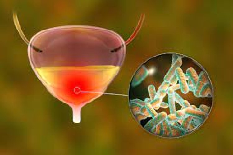 ଏହି ସବୁ ଲକ୍ଷଣକୁ ହୋଇପାରେ ୟୁରିନାରୀ ଟ୍ରାକ୍ଟ ଇନଫେକ୍ସନ