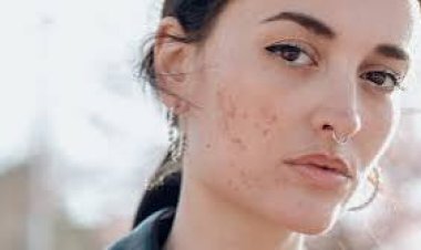 ଆପଣଙ୍କର ସ୍କିନ୍ ଏଲର୍ଜି  ଅଛି କି? ସାବଧାନ