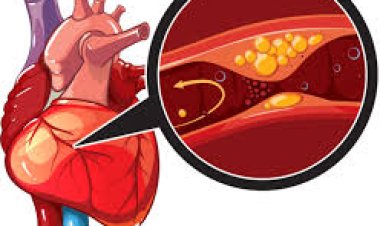 ହୃଦଘାତର ଆଶଙ୍କା କାହାକୁ ବେଶୀ?