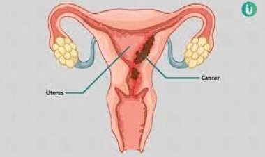 ଜାଣନ୍ତୁ, ଗର୍ଭାଶୟ ସମ୍ବଦ୍ଧରେ କିଛି ବିଶେଷ ତଥ୍ୟ