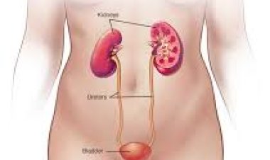 ଏପରି ପାଆନ୍ତୁ ପରିସ୍ରା ପୋଡ଼ା ରୋଗରୁ ମୁକ୍ତି