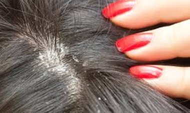 ରୁପି ହେବାର କାରଣ ? ଜାଣନ୍ତୁ