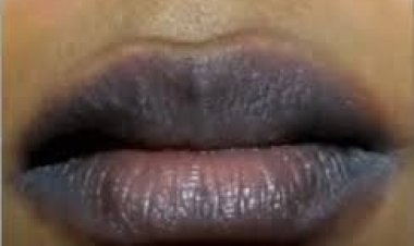 ଘରୋଇ ଉପାୟରେ ଓଠକୁ ଗୋଲାପି କରନ୍ତୁ