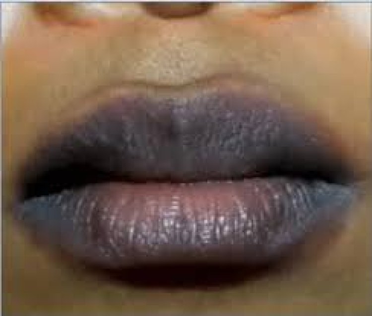 ଘରୋଇ ଉପାୟରେ ଓଠକୁ ଗୋଲାପି କରନ୍ତୁ