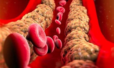 କୋଲେଷ୍ଟ୍ରଲ୍ ବଢ଼ିଲେ ହୋଇପାରେ ସମସ୍ୟା