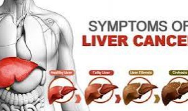 ଲିଭର କ୍ୟାନସରରେ ଦେଖାଦେଇଥାଏ ବଡ଼ ଲକ୍ଷଣ